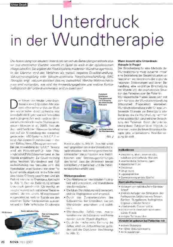 Vorschauseite 1: Unterdruck in der Wundtherapie