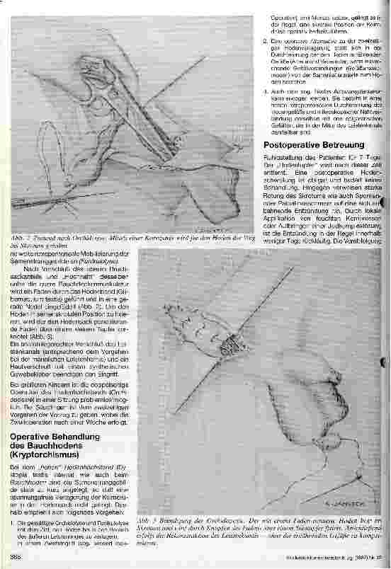 Vorschauseite 3: Der Hodenhochstand