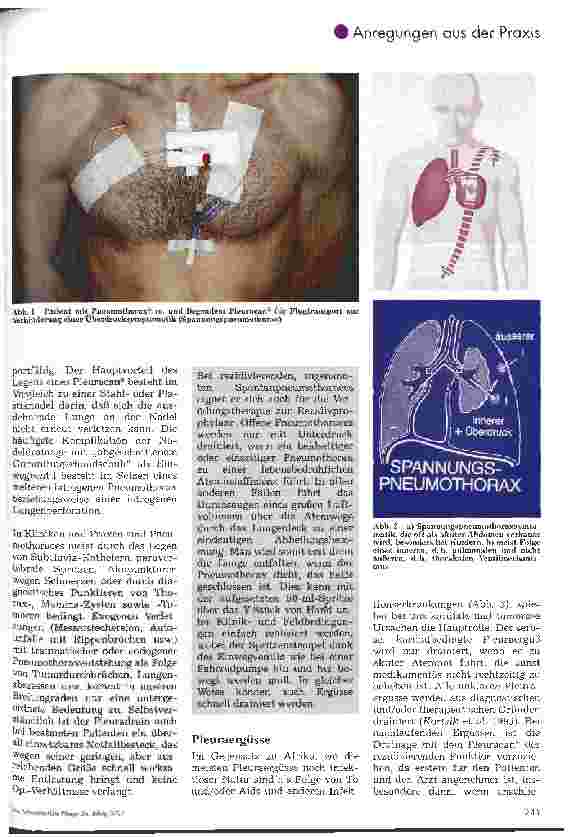 Vorschauseite 2: Thorax-, Pleura-, Pulmo-, Perikard-, und Peritonealdrainage mit speziellem Einmalbesteck