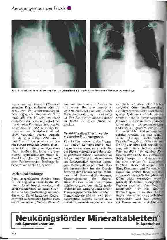 Vorschauseite 5: Thorax-, Pleura-, Pulmo-, Perikard-, und Peritonealdrainage mit speziellem Einmalbesteck