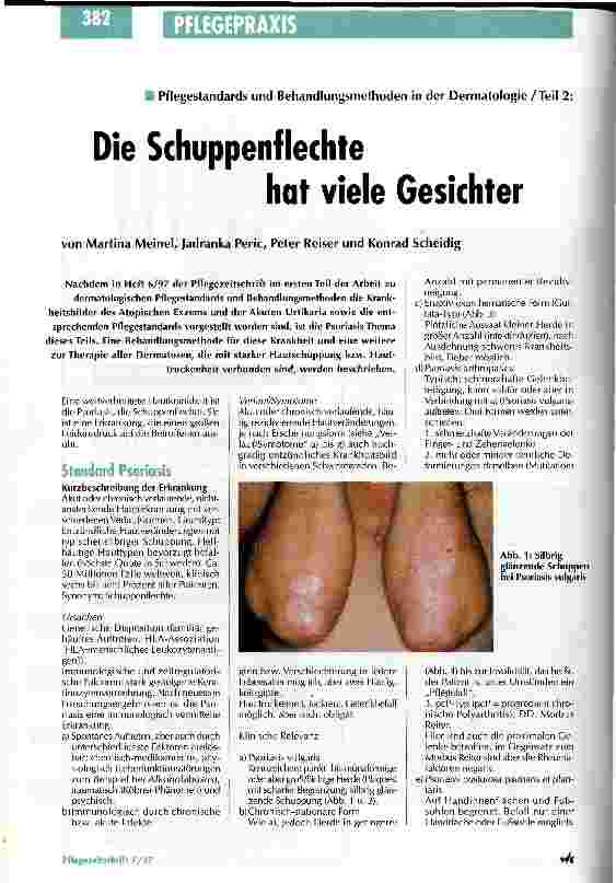 Vorschauseite 1: Die Schuppenflechte hat viele Gesichter Pflegestandards und Behandlungsmethoden in der Dermatologie Teil 2