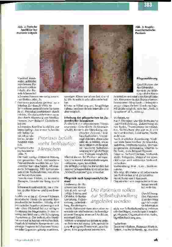 Vorschauseite 2: Die Schuppenflechte hat viele Gesichter Pflegestandards und Behandlungsmethoden in der Dermatologie Teil 2