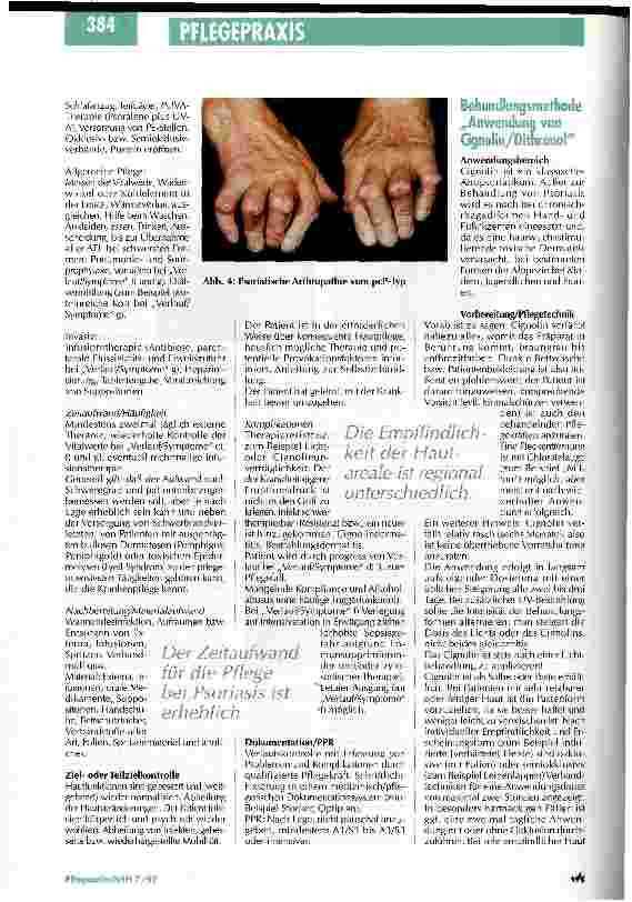 Vorschauseite 3: Die Schuppenflechte hat viele Gesichter Pflegestandards und Behandlungsmethoden in der Dermatologie Teil 2