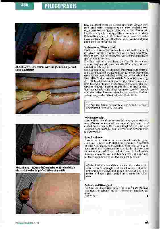 Vorschauseite 5: Die Schuppenflechte hat viele Gesichter Pflegestandards und Behandlungsmethoden in der Dermatologie Teil 2
