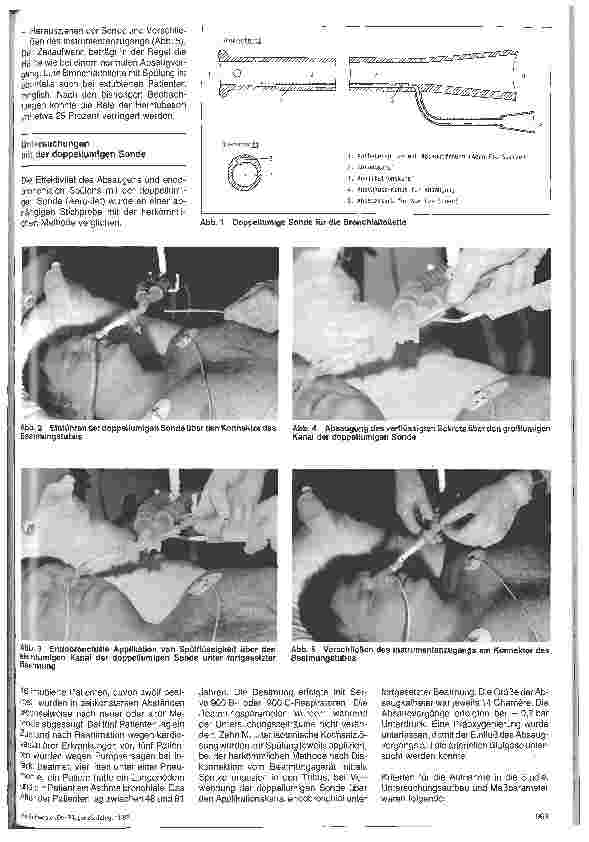 Vorschauseite 2: Anwendung eines neuen doppellumigen Katheters in der Intensivbehandlung // Verbesserte Bronchialtoilette