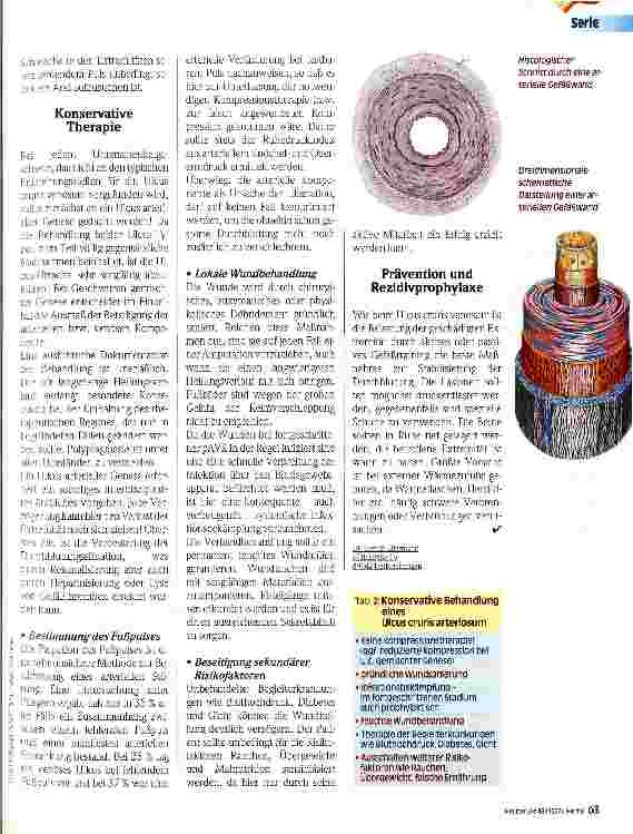Vorschauseite 2: Wundversorgung in der Pflege Ulcus cruris arteriosum - Konservative Therapie und Prophylaxe