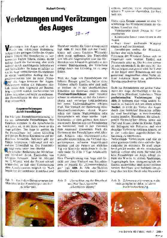 Vorschauseite 1: Verletzungen und Verätzungen des Auges.