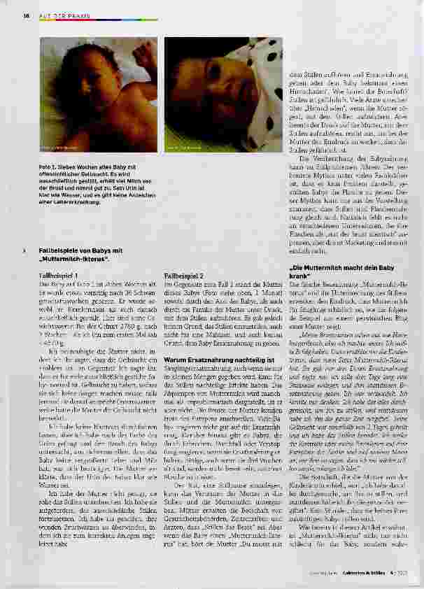 Vorschauseite 2: Das fälschlicherweise als „Muttermilch-Ikterus bezeichnete Phänomen