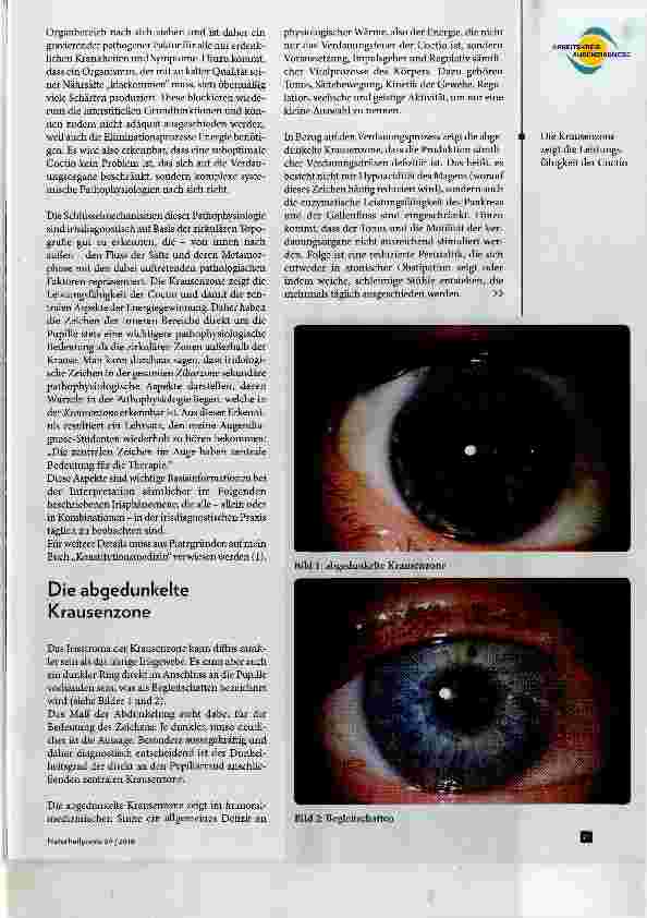 Vorschauseite 2: Die vier wichtigsten Zeichen der Irisdiagnostik Teil 1