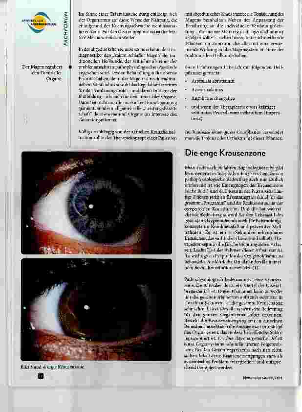 Vorschauseite 3: Die vier wichtigsten Zeichen der Irisdiagnostik Teil 1