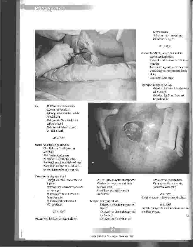 Vorschauseite 3: Sacraldecubitus