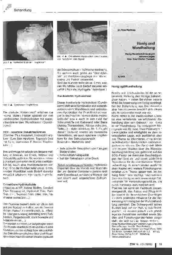Vorschauseite 2: Moderne Wundauflagen (Teil 2) Hydrokolloide