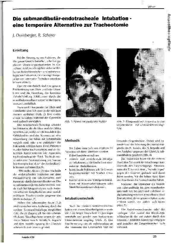 Vorschauseite 1: Die submandibulär-endotracheale Intubation -eine temporäre Alternative zur Tracheotomie
