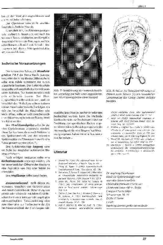 Vorschauseite 3: Die submandibulär-endotracheale Intubation -eine temporäre Alternative zur Tracheotomie