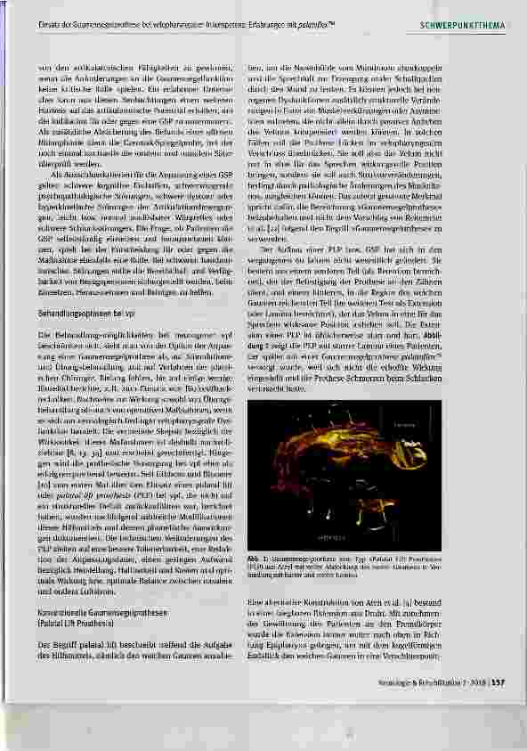 Vorschauseite 3: Einsatz der Gaumensegelprothese bei velopharyngealer Inkompetenz: Erfahrungen mit palatoflex™
