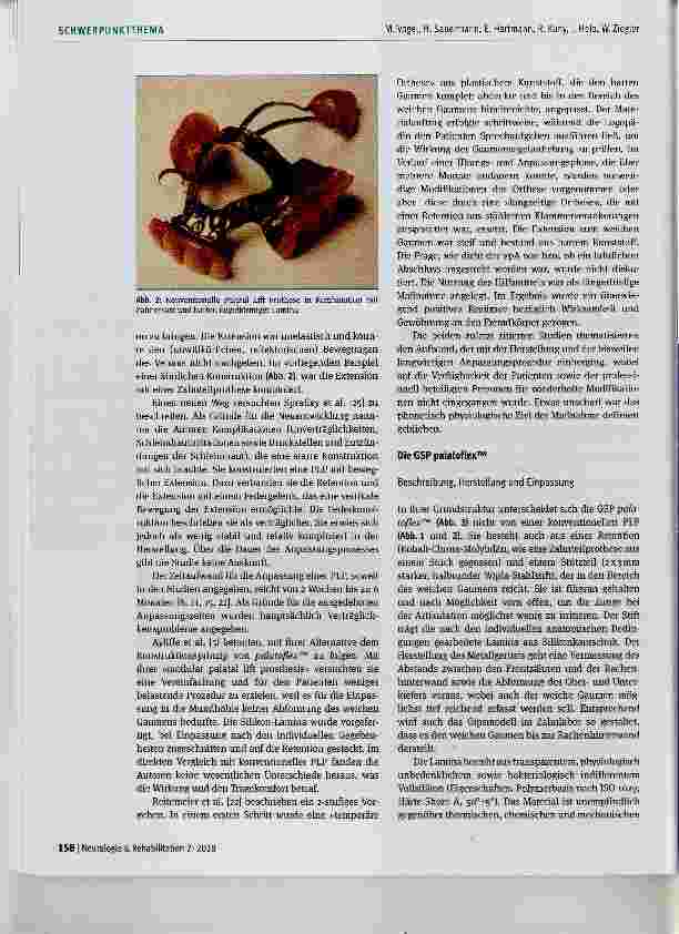 Vorschauseite 4: Einsatz der Gaumensegelprothese bei velopharyngealer Inkompetenz: Erfahrungen mit palatoflex™
