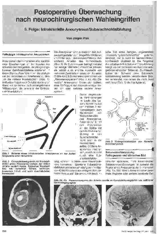 Vorschauseite 1: Postoperative Überwachung nach neurochirurgischen Wahleingriffen 5. Folge: Intrakranielle Aneurysem/Subarachnoidalblutungen