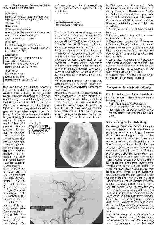 Vorschauseite 2: Postoperative Überwachung nach neurochirurgischen Wahleingriffen 5. Folge: Intrakranielle Aneurysem/Subarachnoidalblutungen
