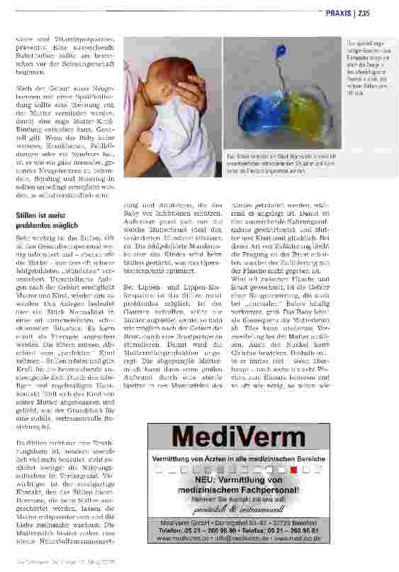 Vorschauseite 2: Die Geburt eines Kindes mit Lippen-, Kiefer-, Gaumenspalte