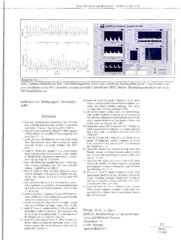 Vorschauseite 3: NEUE TRENDS IN DER BEATMUNG NOISY VENTILATION?