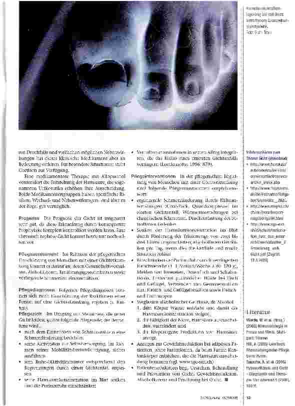 Vorschauseite 3: Hyperurikämie und Gicht