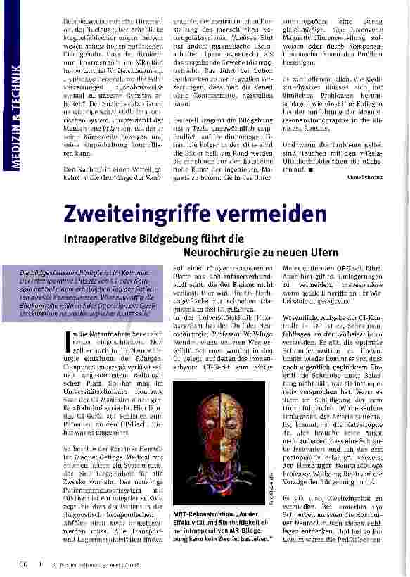 Vorschauseite 1: Zweiteingriffe vermeiden. Intraoperative Bildgebung führt dieNeurochirurgie zu neuen Ufern