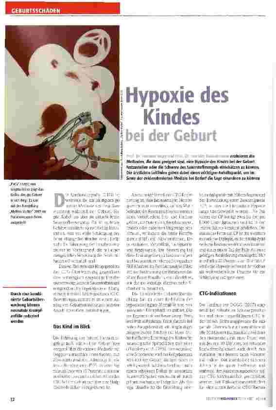 Vorschauseite 1: Hypoxie des Kindes bei der Geburt