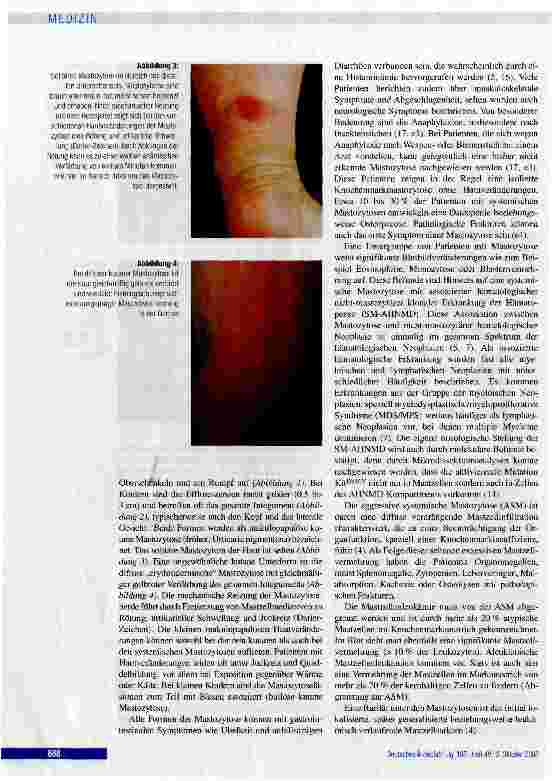 Vorschauseite 3: Die Mastozytose Eine Erkrankung der hämopoettschen Stammzell