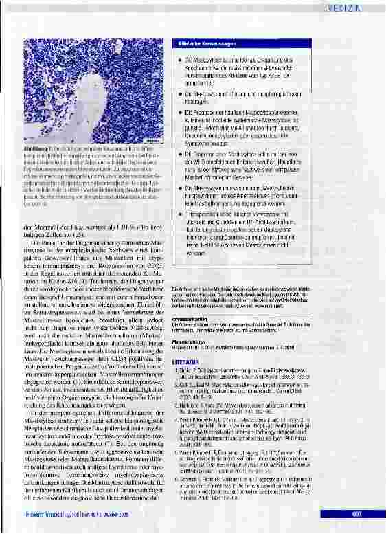 Vorschauseite 6: Die Mastozytose Eine Erkrankung der hämopoettschen Stammzell