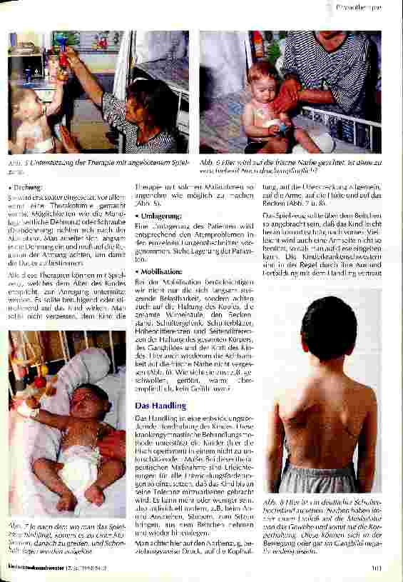 Vorschauseite 3: Atemtherapie (Physiotherapie) bei herzkranken Kindern