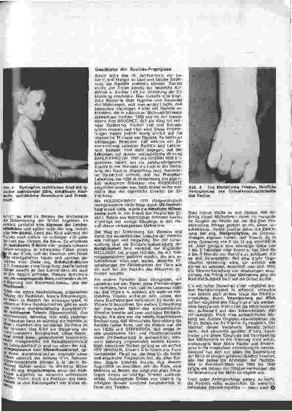 Vorschauseite 2: Kinderheilkunde 7. Folge: Rachitis und Rachitisprophylaxe
