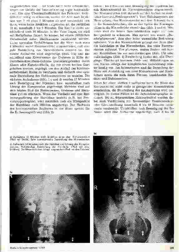 Vorschauseite 2: Röntgendemonstration 9. Folge: Intravenöse Urographie und retrograde Pyelographie