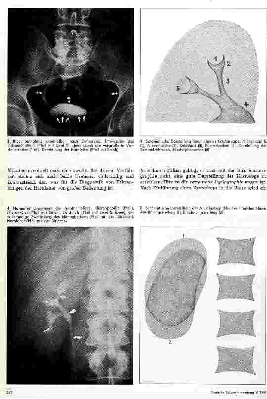 Vorschauseite 3: Röntgendemonstration 9. Folge: Intravenöse Urographie und retrograde Pyelographie
