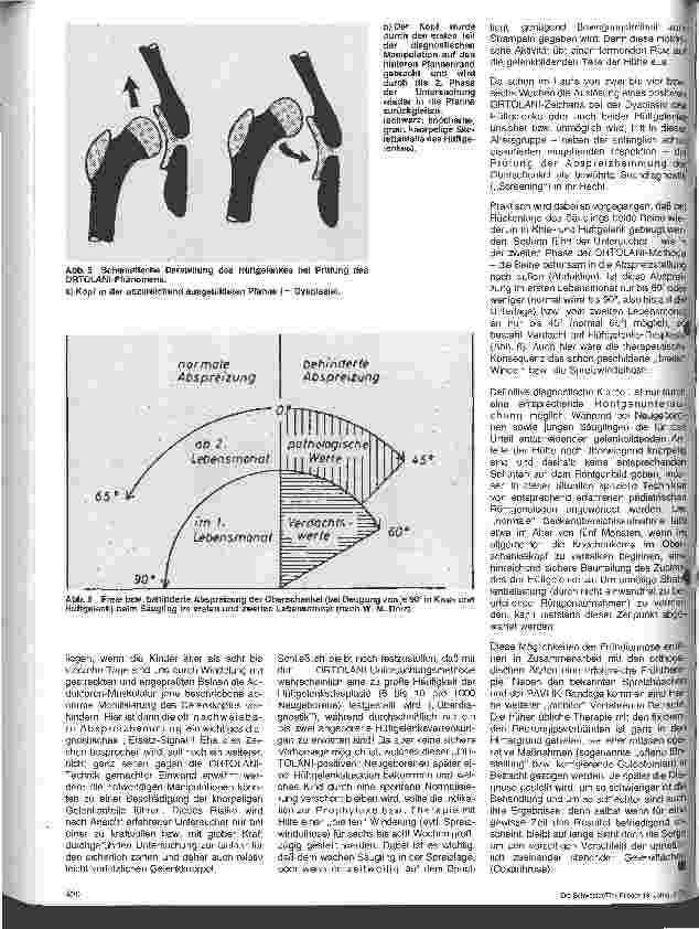 Vorschauseite 3: Kinderheilkunde Screening Test zur Frühdiagnose angeborener Krankh. 2. Folge: Die Frühdiagnose der angeborenen Hüftgelenksverrenkung