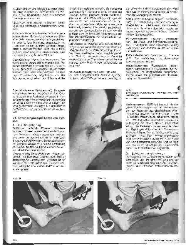 Vorschauseite 3: Möglichkeiten und Grenzen des Einsatzes von PVP-Jod-Präparaten
