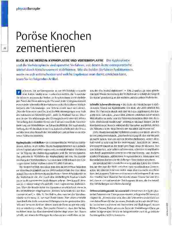 Vorschauseite 1: Poröse Knochen zementieren