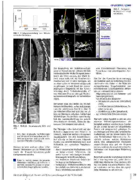 Vorschauseite 2: Tumorund Metastasenchirurgie an der Wirbelsäule