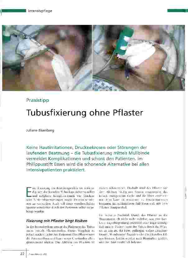 Vorschauseite 1: Tubusfixierung ohne Pflaster
