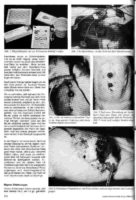 Vorschauseite 2: Hautpflege bei Anus praeter