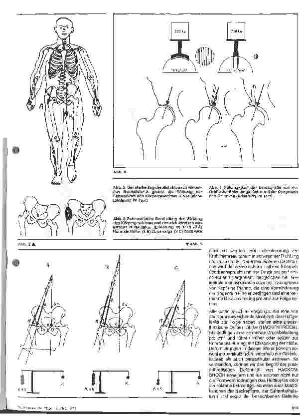 Vorschauseite 2: Pathophysiologische Vorgänge im Bereich des Hüftgelenkes Orthopädie 1. Folge