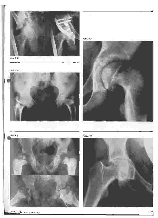 Vorschauseite 4: Pathophysiologische Vorgänge im Bereich des Hüftgelenkes Orthopädie 1. Folge