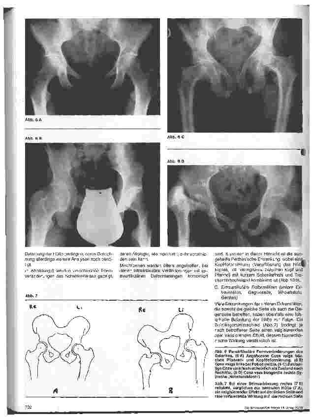 Vorschauseite 5: Pathophysiologische Vorgänge im Bereich des Hüftgelenkes Orthopädie 1. Folge