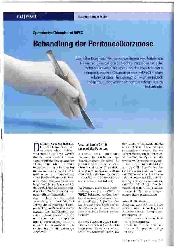 Vorschauseite 1: Behandlung der Peritonealkarzinome