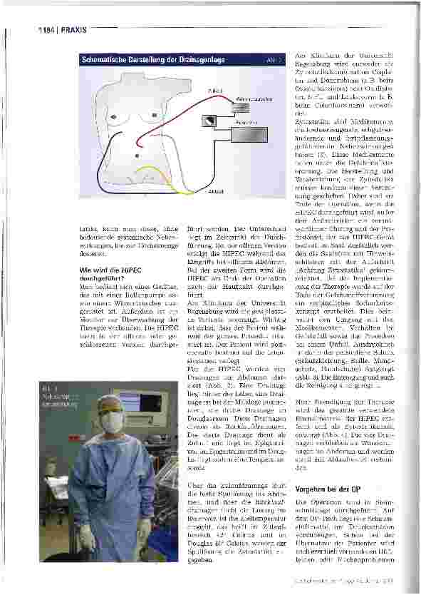 Vorschauseite 3: Behandlung der Peritonealkarzinome