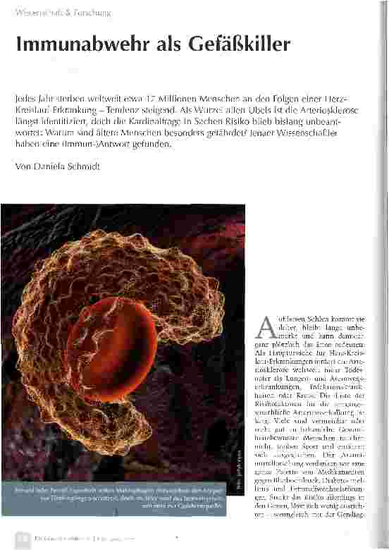 Vorschauseite 1: Immunabwehr als Gefäßkiller