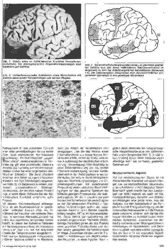Vorschauseite 2: Dementielle Syndrome im Alter Ursachen, Verlauf und Behandlungsmöglichkeiten