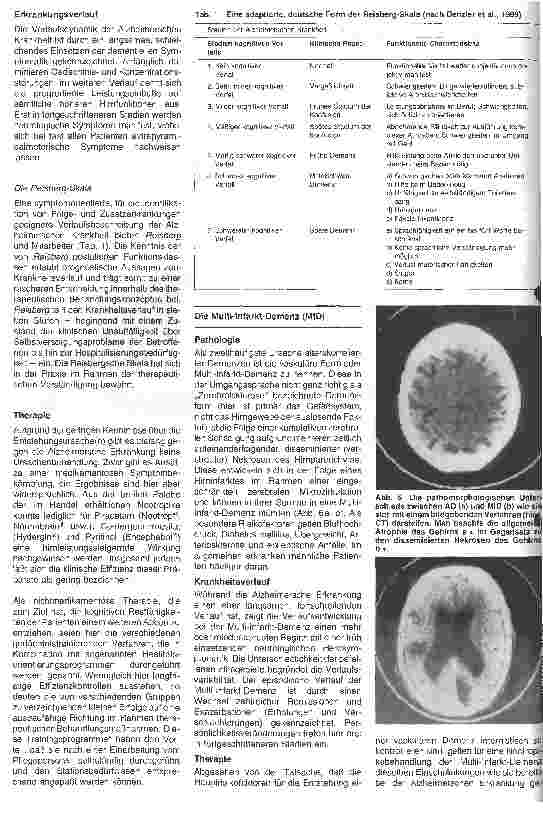 Vorschauseite 3: Dementielle Syndrome im Alter Ursachen, Verlauf und Behandlungsmöglichkeiten