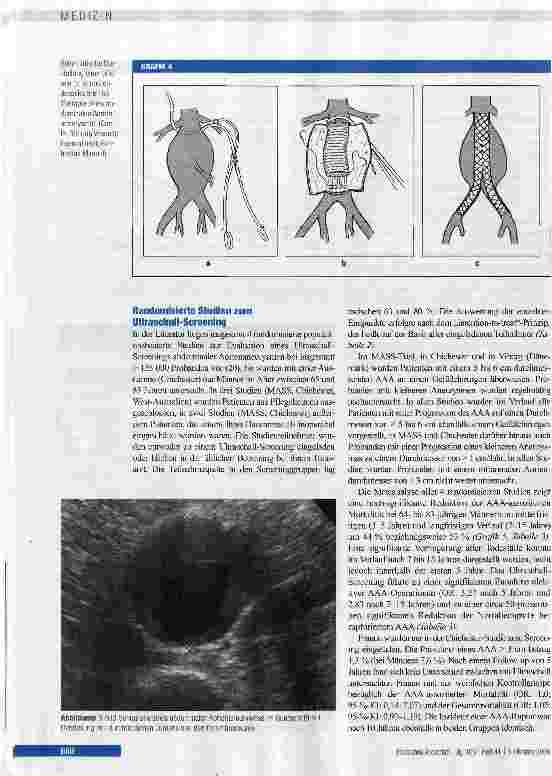 Vorschauseite 4: Ultraschall-Screening abdominaler Aortenaneurysmen