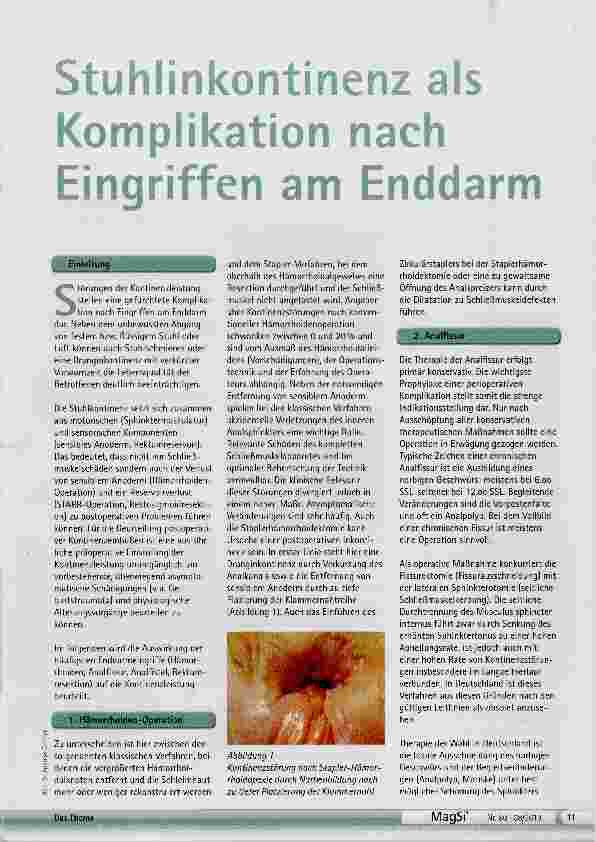 Vorschauseite 1: Stuhlinkontinenz als Komplikation nach Eingriffen am Enddarm