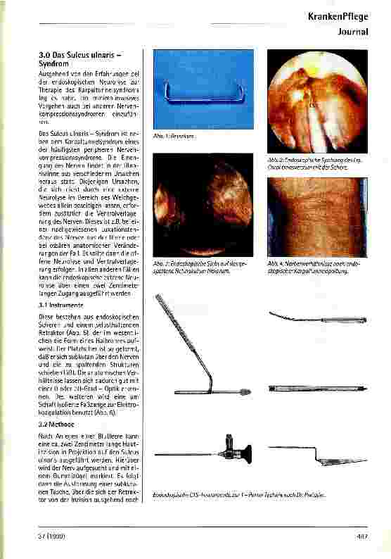 Vorschauseite 2: Endoskopische Methoden in der peripheren Nervenchirurgie
